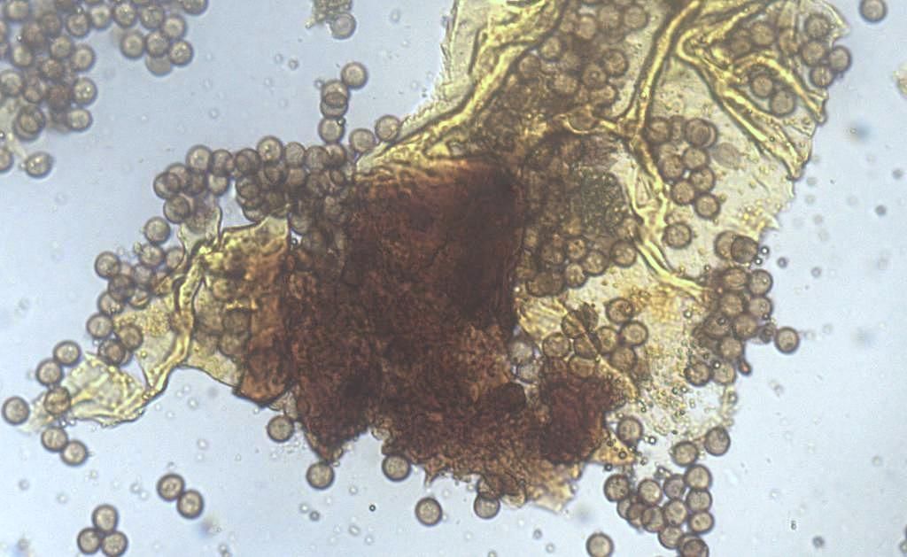 Physarum lateritium?